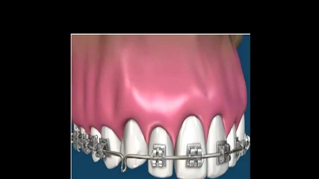 کلینیک دندانپزشکی | ارتودنسی دندان
