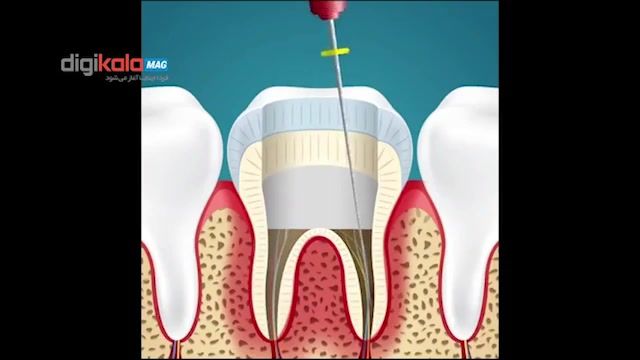 نجات دندان های ما توسط دندان پزشکان چوگنه است؟