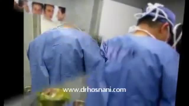 Open rhinoplasty nose surgery by Dr HOSNANI (Iranian nose surgeon) فیلم عمل جراحی بینی دکتر حسنانی