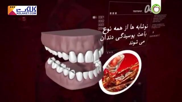 ببینید خوردن چه چیزهایی برای سلامت دندان مفید و چه چیزهایی مضر است؟