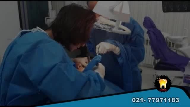 فیلم جراحی کاشت ایمپلنت در دندانپزشکی تهران 