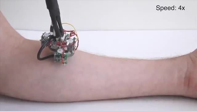 ابداع ربات پزشک - ربات اسکین‌ بوت  با حرکت روی پوست بدن ، شخص را معاینه می کند