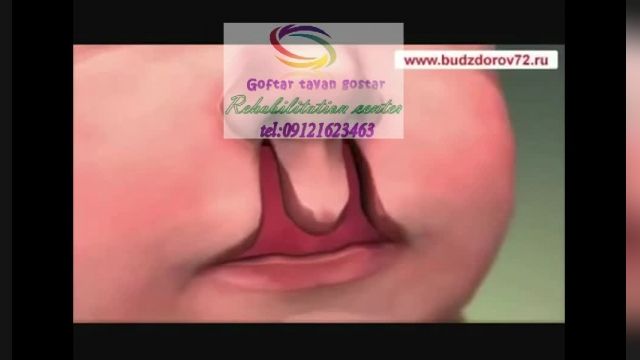   کلینیک گفتاردرمانی در کرج 02634471795،  جهانشهر خیابان رضایی