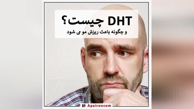  تاثیر DHT در ریزش مو 