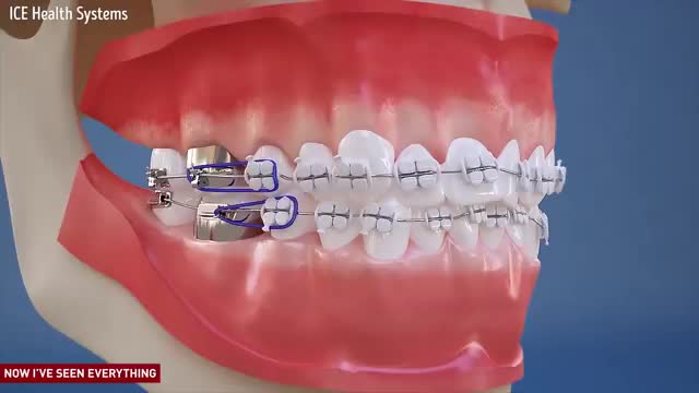 ارتودنسی دندان | کلینیک دندانپزشکی تاج