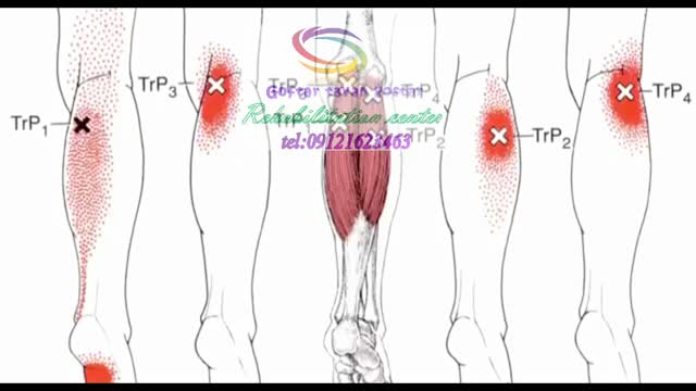 مراکز فوق تخصصی کاردرمانی پا در کرج|گفتار توان گستر البرز091216234663