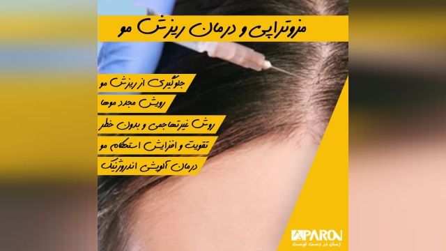  برای درمان ریزش مو از مزوتراپی استفاده کنید 