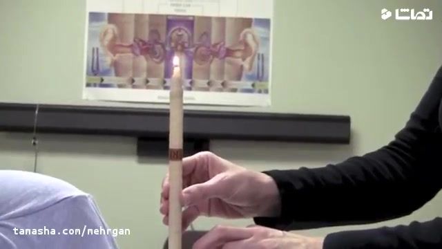 ویدیویی برای آشنا شدن با نحوی عملکرد شمع گوش 