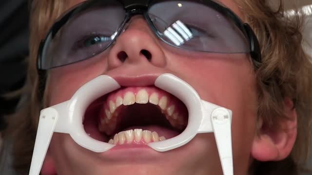 نحوه چسباندن براکت در درمان ارتودنسی|کلینیک دندانپزشکی مدرن