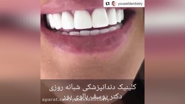 دندانپزشکی دکتر یوسف بالوی پور