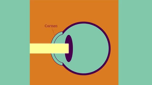 ابداع قطره چشم مبتنی بر فناوری نانو برای رفع مشکل دوربینی و نزدیک بینی 