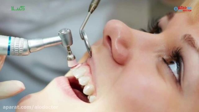 برای پر کردن دندان از کدام ماده استفاده کنیم آمالگام یا کامپوزیت؟