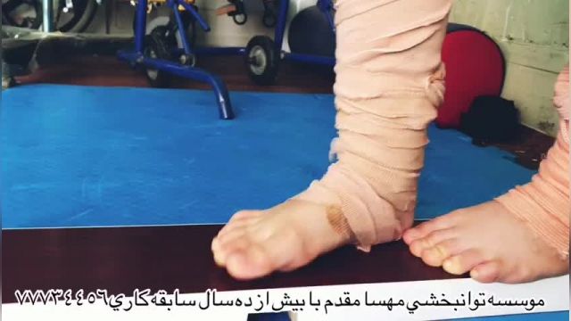 پارت48- بهترین کلینیک توانبخشی تهران - توانبخشی مهسا مقدم