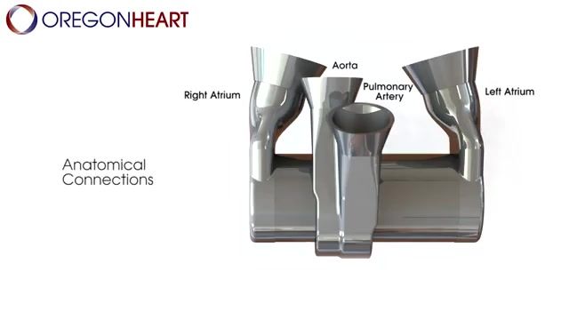 ساخت قلب مصنوعی ساده با استفاده از آلیاژ تیتانیوم  
